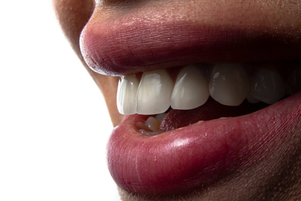 a close-up of a person's mouth with teeth showing